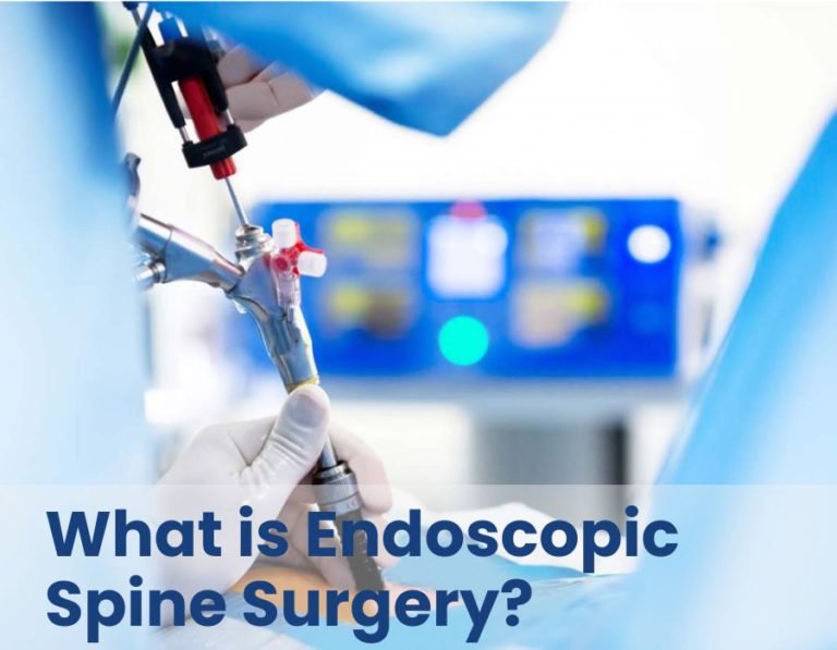 What Is Endoscopic Spine Surgery Orthos Centre