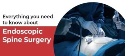 What is Endoscopic Spine Surgery