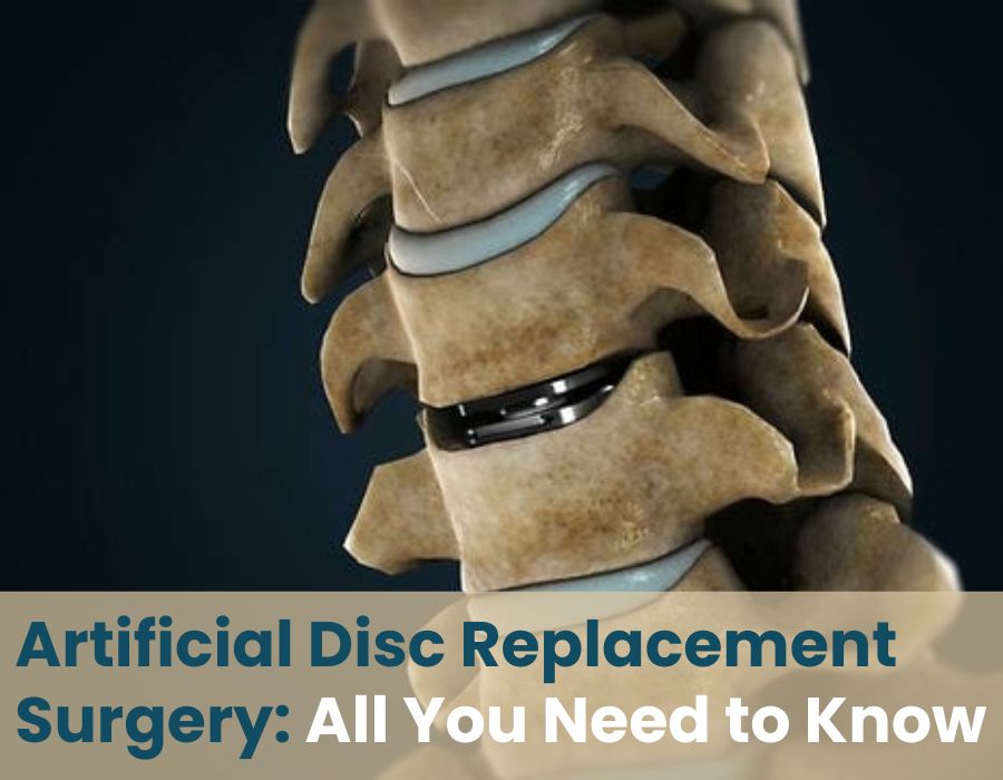artificial disc replacement surgery-Orthos Centre-Dr. Shrikant dalal