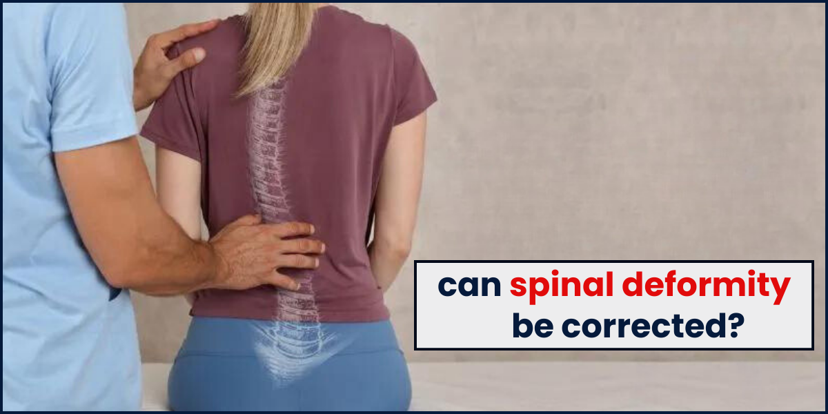 Can spinal deformity be corrected?