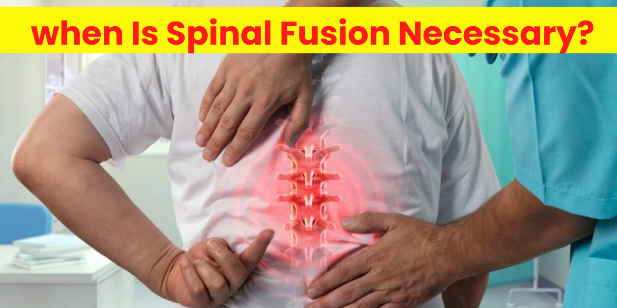 Spine specialist in Pune | Spine Centre in Pune | When is Spinal Fusion Necessary?