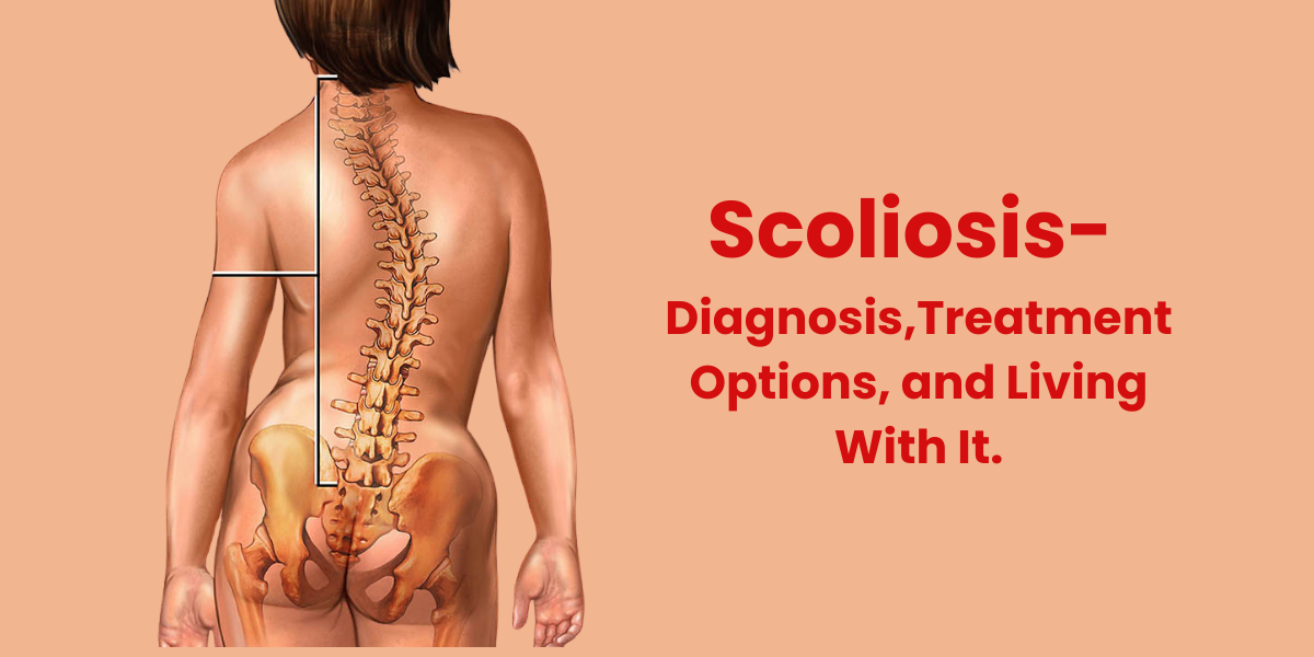 Spine Specialist in Pune | Scoliosis: Diagnosis, Treatment Options, and Living With It.