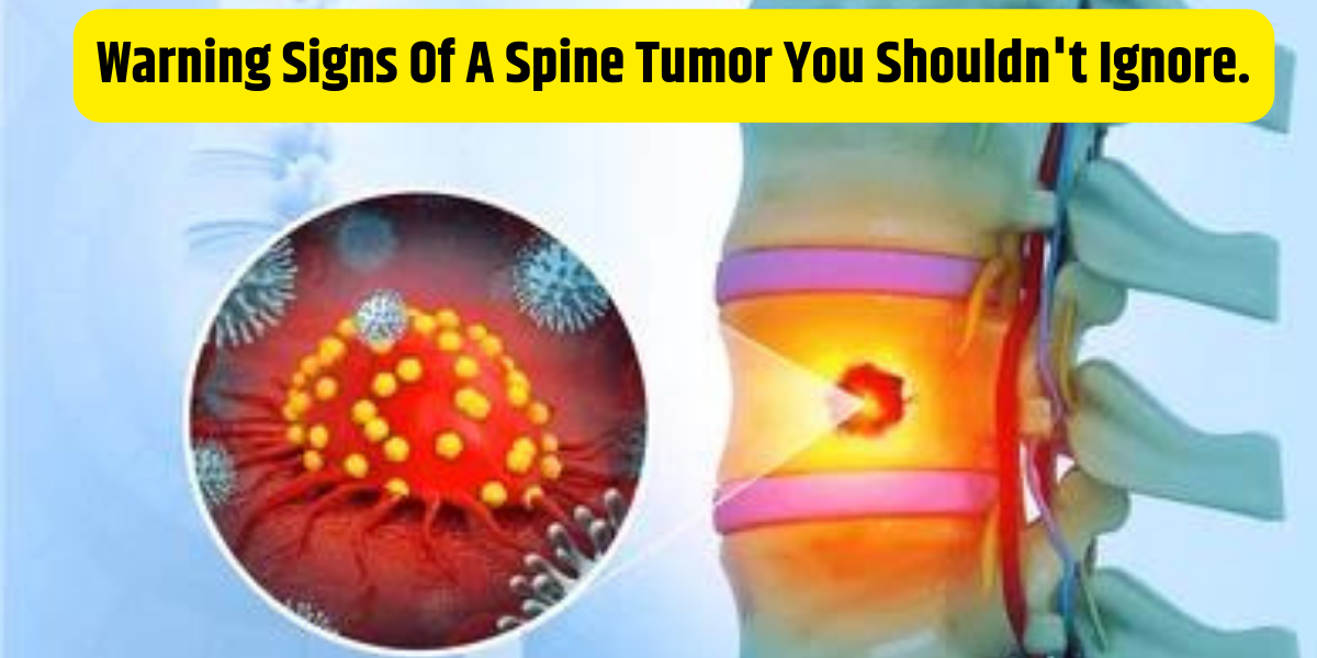Warning Signs of a Spine Tumor You Shouldn't Ignore.| spine specialist in Pune