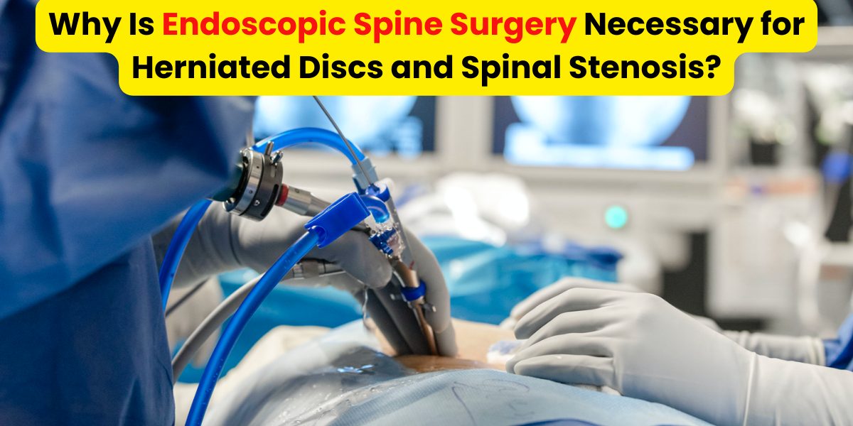 Why Is Endoscopic Spine Surgery Necessary for Herniated Discs and Spinal Stenosis? | Spine clinic in Pune