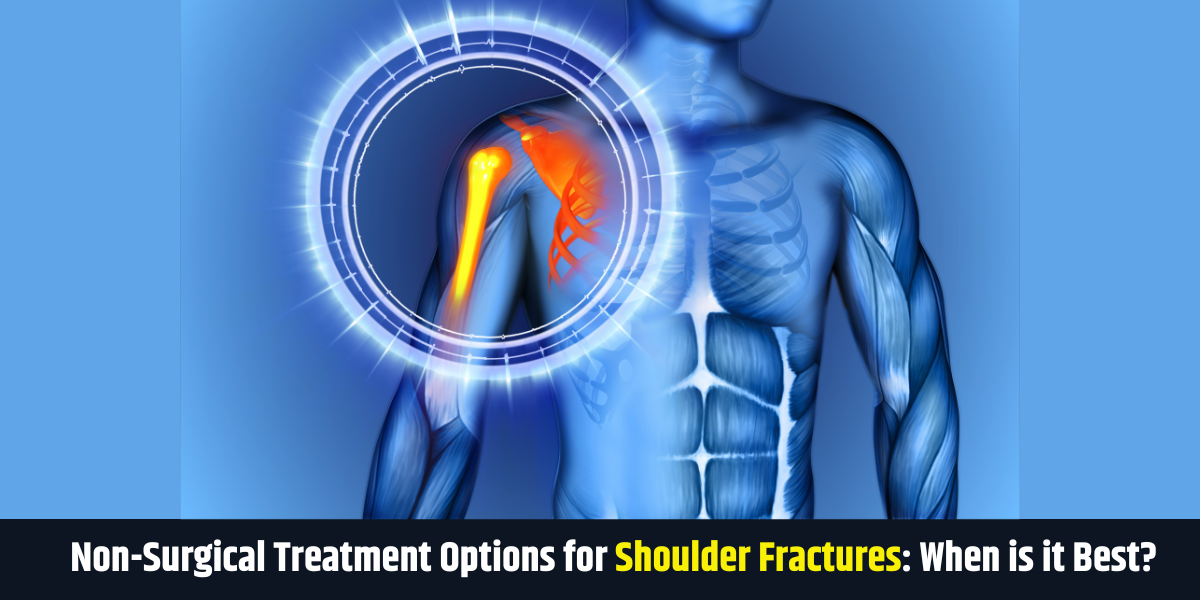 Non-Surgical Treatment Options for Shoulder Fractures: When is it Best?