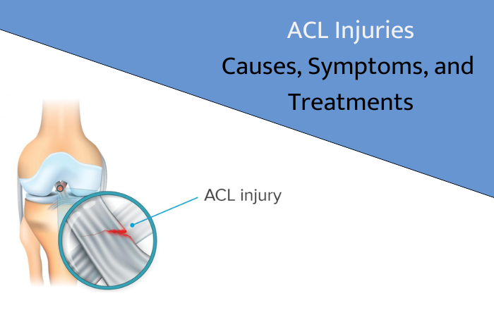 ACL Injuries Causes, Symptoms, and Treatments