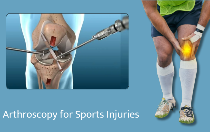 The Benefits of Arthroscopy for Sports Injuries