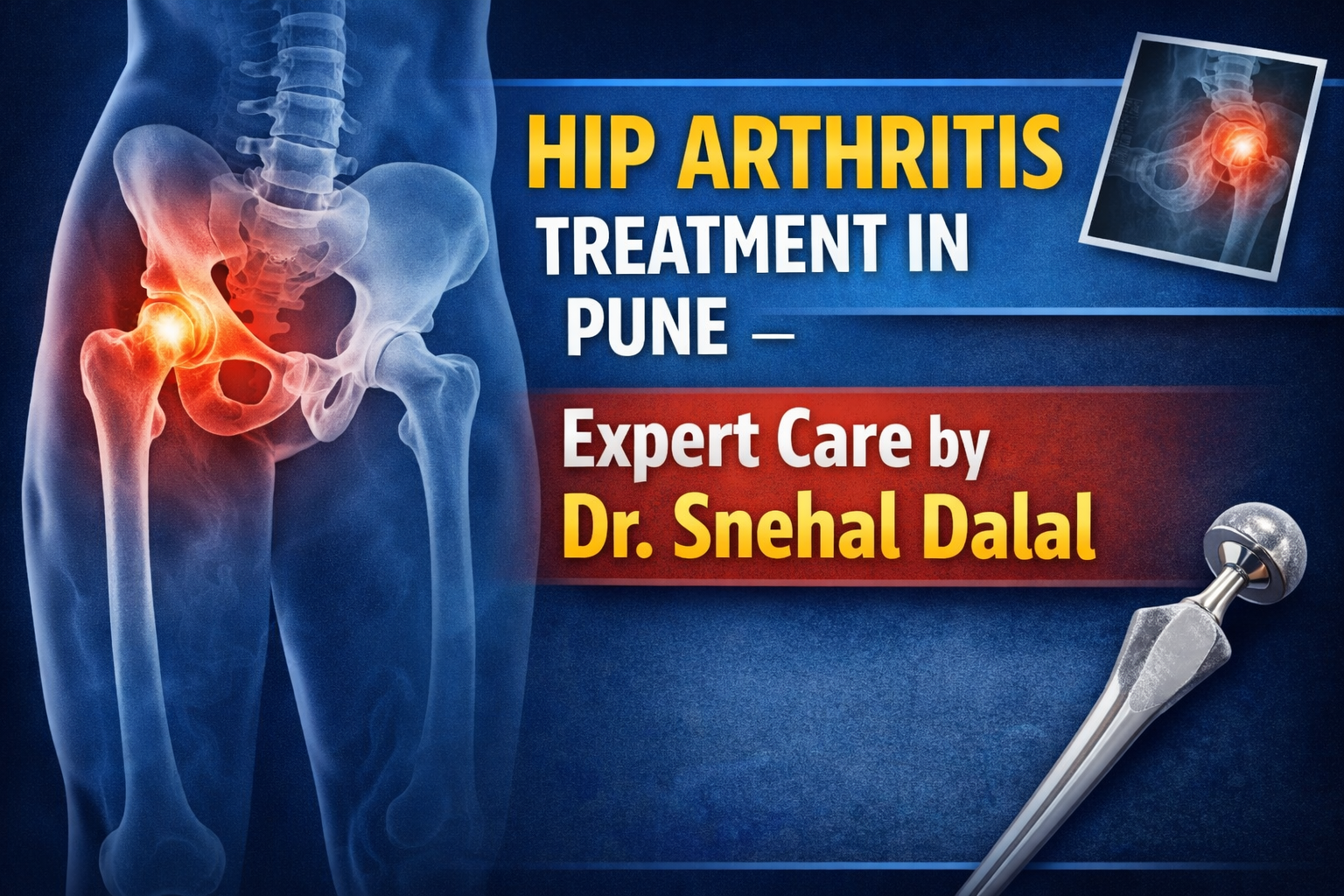 Hip Arthritis Treatment in Pune