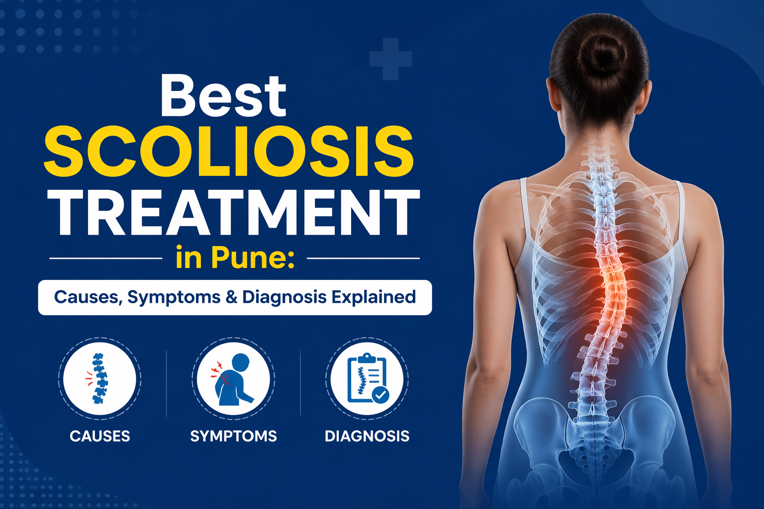 Best Scoliosis Treatment in Pune