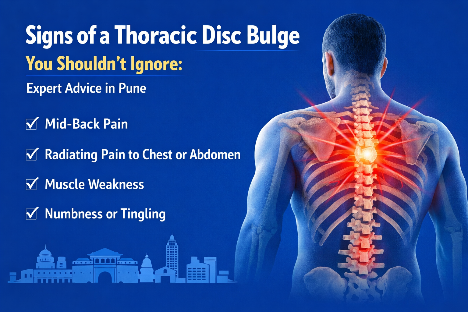 Thoracic Disc Bulge